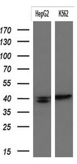 KRT19 Monoclonal Antibody (OTI8H7), TrueMAB , OriGene 100 &mu;L; Unconjugated:Antibodies,