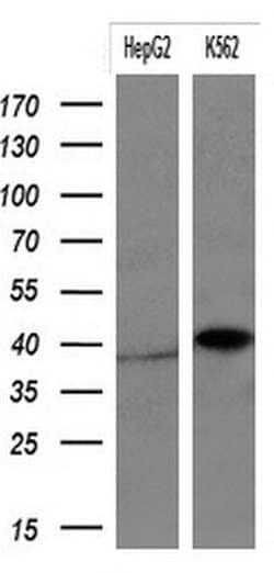 KRT19 Monoclonal Antibody (OTI7H1), TrueMAB , OriGene 100 &mu;L; Unconjugated:Antibodies,
