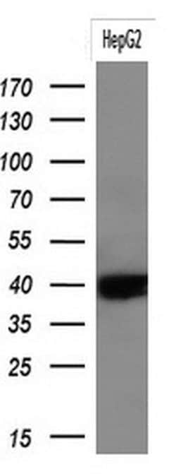KRT19 Monoclonal Antibody (OTI1A8), TrueMAB , OriGene 30 &mu;L; Unconjugated:Antibodies,