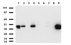 KRT19 Mouse anti-Human, Clone: UMAB186, lyophilized, UltraMAB 100 &mu;g;