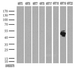 KRT19 Mouse anti-Human, Clone: UMAB186, lyophilized, UltraMAB 100 &mu;g;