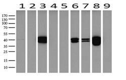 KRT19 Mouse anti-Human, Clone: UMAB187, lyophilized, UltraMAB 100 &mu;g | Buy Online | OriGene | Fisher Scientific