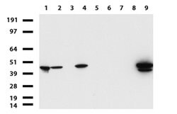 KRT19 Mouse anti-Human, Clone: UMAB187, lyophilized, UltraMAB 100 &mu;g | Buy Online | OriGene | Fisher Scientific