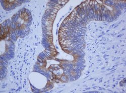 KRT20 Monoclonal Antibody (OTI4A2), TrueMAB , OriGene 100 &mu;L; Unconjugated:Antibodies,
