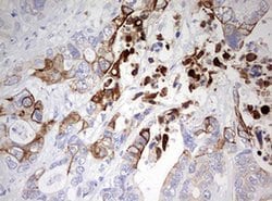 KRT20 Monoclonal Antibody (OTI2A2), TrueMAB , OriGene:Antibodies:Primary