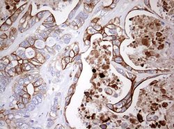 KRT20 Monoclonal Antibody (OTI11A1), TrueMAB , OriGene 100 &mu;L; Unconjugated:Antibodies,