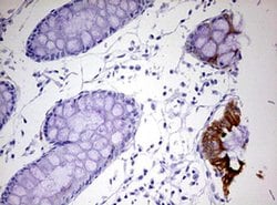 KRT20 Monoclonal Antibody (OTI4B4), TrueMAB , OriGene 100 &mu;L; Unconjugated:Antibodies,