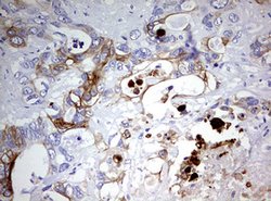 KRT20 Mouse anti-Human, Clone: OTI5F7, lyophilized, TrueMAB 100 &mu;g;