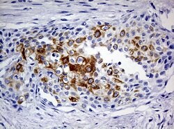 KRT20 Mouse anti-Human, Clone: OTI10D5, lyophilized, TrueMAB 100 &mu;g;