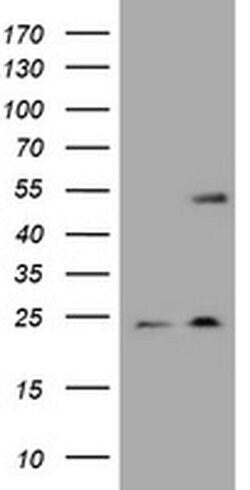 KRT20 Monoclonal Antibody (OTI4A2), TrueMAB , OriGene 100 &mu;L; Unconjugated:Antibodies,