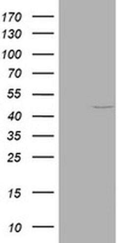 KRT20 Monoclonal Antibody (OTI6D5), TrueMAB , OriGene:Antibodies:Primary