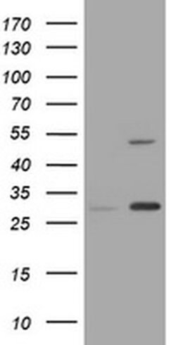 KRT20 Monoclonal Antibody (OTI3A5), TrueMAB , OriGene:Antibodies:Primary