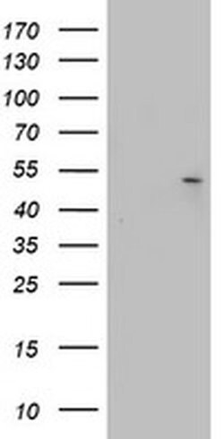 KRT20 Monoclonal Antibody (OTI6G4), TrueMAB , OriGene:Antibodies:Primary