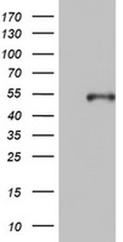 KRT20 Monoclonal Antibody (OTI2A2), TrueMAB , OriGene 100 &mu;L; Unconjugated:Antibodies,