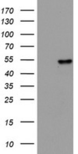 KRT20 Mouse anti-Human, Clone: OTI11A1, lyophilized, TrueMAB 100 &mu;g;
