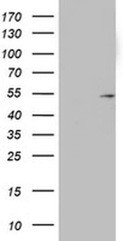 KRT20 Monoclonal Antibody (OTI4B4), TrueMAB , OriGene 100 &mu;L; Unconjugated:Antibodies,