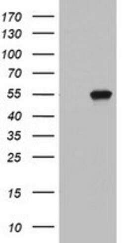 KRT20 Mouse anti-Human, Clone: OTI5F7, lyophilized, TrueMAB 100 &mu;g;