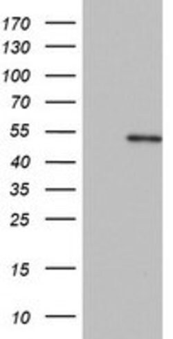 KRT20 Mouse anti-Human, Clone: OTI5A2, lyophilized, TrueMAB 100 &mu;g;