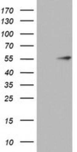 KRT20 Mouse anti-Human, Clone: OTI10D5, lyophilized, TrueMAB 100 &mu;g;