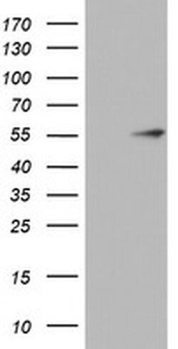 KRT20 Monoclonal Antibody (OTI10D5), TrueMAB , OriGene 100 &mu;L; Unconjugated:Antibodies,