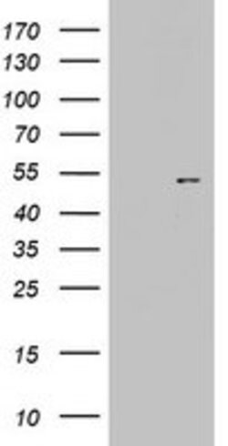 KRT20 Mouse anti-Human, Clone: OTI5F1, lyophilized, TrueMAB 100 &mu;g;