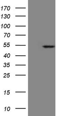 KRT23 Monoclonal Antibody (OTI3F2), TrueMAB , OriGene:Antibodies:Primary