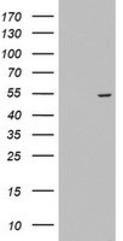 KRT24 Mouse anti-Human, Clone: OTI2F8, lyophilized, TrueMAB 100 &mu;g;