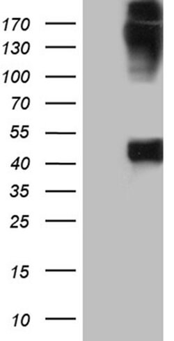 KRT35 Monoclonal Antibody (OTI1A11), TrueMAB , OriGene 100 &mu;L; Unconjugated:Antibodies,