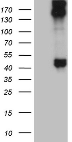 KRT35 Mouse anti-Human, Clone: OTI1A4, lyophilized, TrueMAB 100 &mu;g;