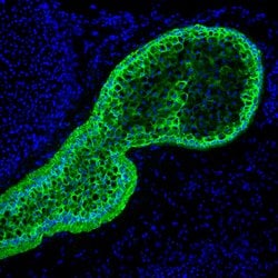 Invitrogen Cytokeratin 5 Monoclonal Antibody (XM26) 500 &mu;L; Unconjugated:Antibodies,