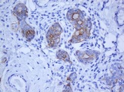 KRT5 Monoclonal Antibody (OTI1F8), TrueMAB , OriGene 100 &mu;L; Unconjugated:Antibodies,