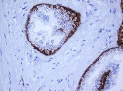 KRT5 Monoclonal Antibody (OTI1F8), TrueMAB , OriGene 100 &mu;L; Unconjugated:Antibodies,