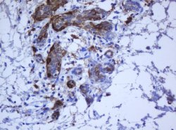 KRT5 Monoclonal Antibody (OTI6F8), TrueMAB , OriGene 100 &mu;L; Unconjugated:Antibodies,