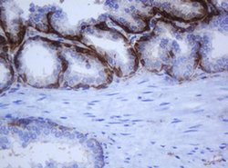 KRT5 Monoclonal Antibody (OTI6F8), TrueMAB , OriGene:Antibodies:Primary