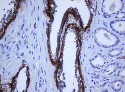 KRT5 Monoclonal Antibody (OTI6F8), TrueMAB , OriGene 100 &mu;L; Unconjugated:Antibodies,