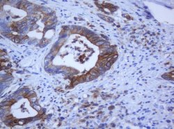 KRT5 Monoclonal Antibody (OTI6F8), TrueMAB , OriGene:Antibodies:Primary