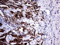 KRT5 Mouse anti-Human, Rat, Clone: OTI1C7, lyophilized, TrueMAB 100 &mu;g;