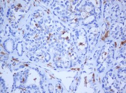 KRT5 Mouse anti-Human, Rat, Clone: OTI1C7, lyophilized, TrueMAB 100 &mu;g;