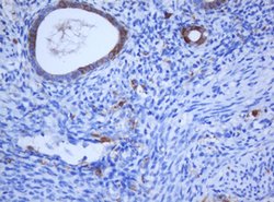 KRT5 Mouse anti-Human, Rat, Clone: OTI1C7, lyophilized, TrueMAB 100 &mu;g;