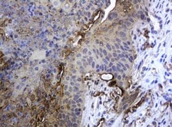 KRT5 Monoclonal Antibody (OTI1E7), TrueMAB , OriGene 100 &mu;L; Unconjugated:Antibodies,