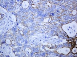 KRT5 Mouse anti-Human, Clone: OTI1E7, lyophilized, TrueMAB 100 &mu;g; Unconjugated:Antibodies,