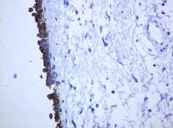KRT5 Monoclonal Antibody (OTI1E7), TrueMAB , OriGene 100 &mu;L; Unconjugated:Antibodies,