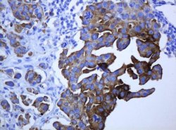 KRT5 Monoclonal Antibody (OTI1E7), TrueMAB , OriGene 100 &mu;L; Unconjugated:Antibodies,