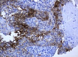 KRT5 Monoclonal Antibody (OTI1E7), TrueMAB , OriGene 100 &mu;L; Unconjugated:Antibodies,