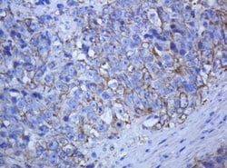 KRT5 Mouse anti-Human, Clone: OTI1E7, lyophilized, TrueMAB 100 &mu;g; Unconjugated:Antibodies,