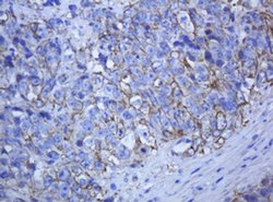 KRT5 Monoclonal Antibody (OTI1E7), TrueMAB , OriGene 100 &mu;L; Unconjugated:Antibodies,