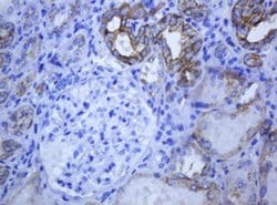 KRT5 Monoclonal Antibody (OTI1E7), TrueMAB , OriGene 100 &mu;L; Unconjugated:Antibodies,
