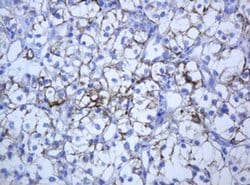 KRT5 Monoclonal Antibody (OTI1E7), TrueMAB , OriGene 100 &mu;L; Unconjugated:Antibodies,