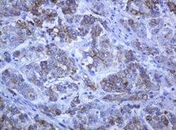 KRT5 Monoclonal Antibody (OTI1E7), TrueMAB , OriGene 100 &mu;L; Unconjugated:Antibodies,