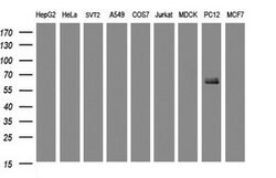 KRT5 Mouse anti-Human, Rat, Clone: OTI1C7, lyophilized, TrueMAB 100 &mu;g;